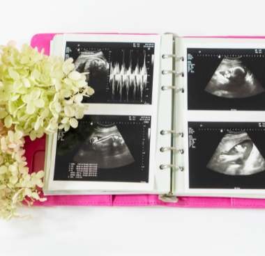 Pregnancy memories / ultrasounds